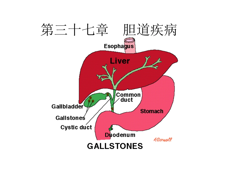 胆道疾病学习_第1页