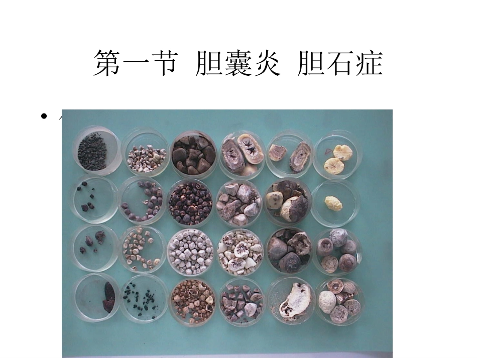 胆道疾病学习_第2页