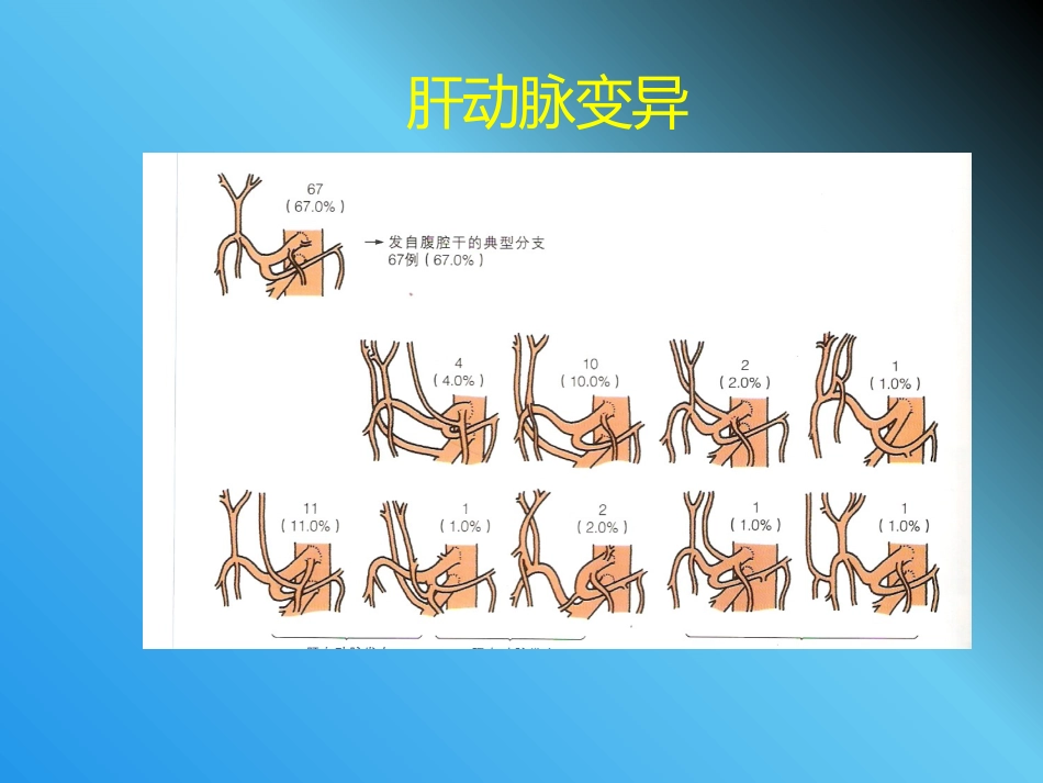腹腔镜胆管损伤_第11页