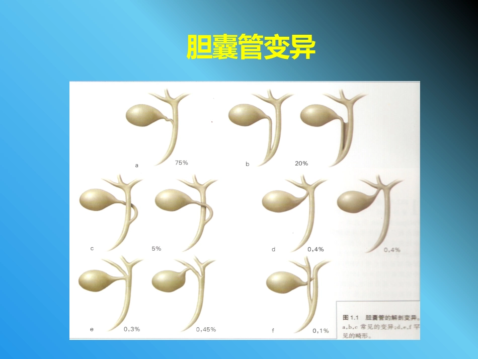 腹腔镜胆管损伤_第7页