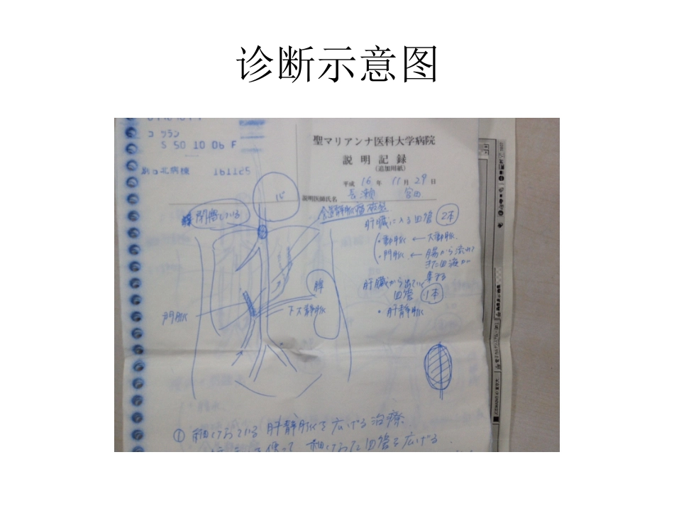 布加综合征肝癌_第7页