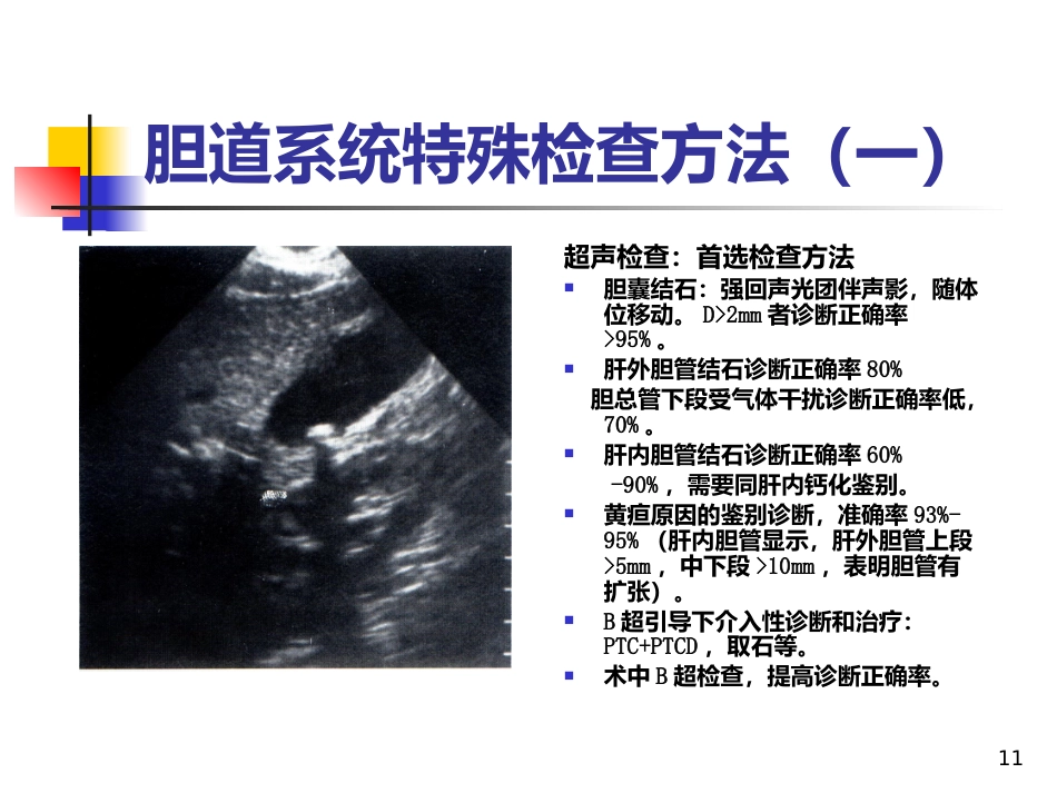 《胆道疾病》PPT课件_第11页