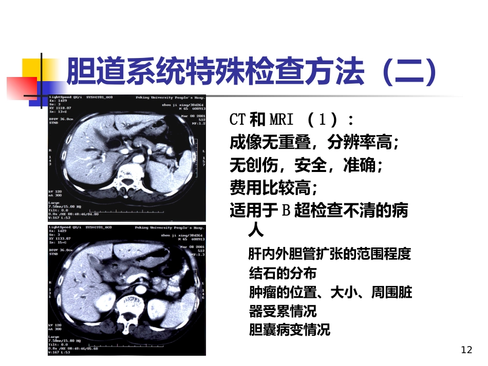 《胆道疾病》PPT课件_第12页