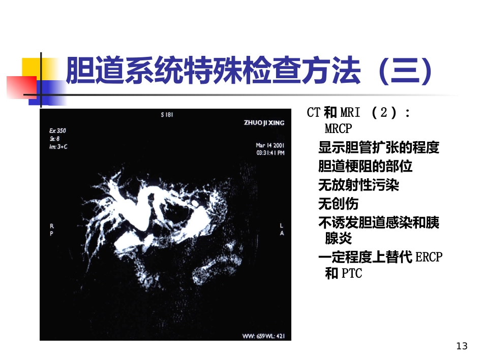 《胆道疾病》PPT课件_第13页