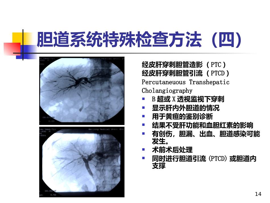 《胆道疾病》PPT课件_第14页