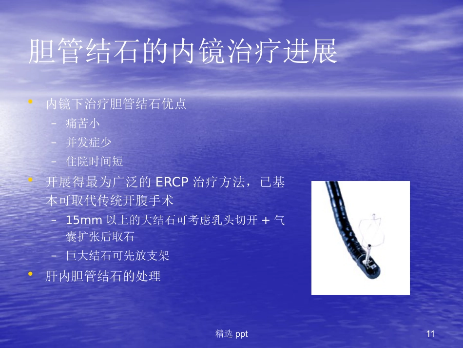ERCP在胆胰疾病中的应用进展_第11页