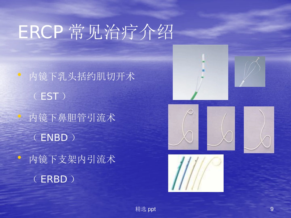 ERCP在胆胰疾病中的应用进展_第9页