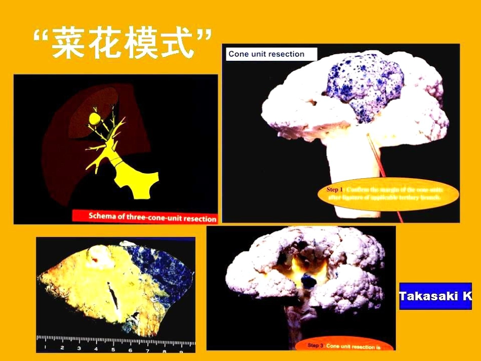 d时代肝胆胰外科PPT课件_第14页