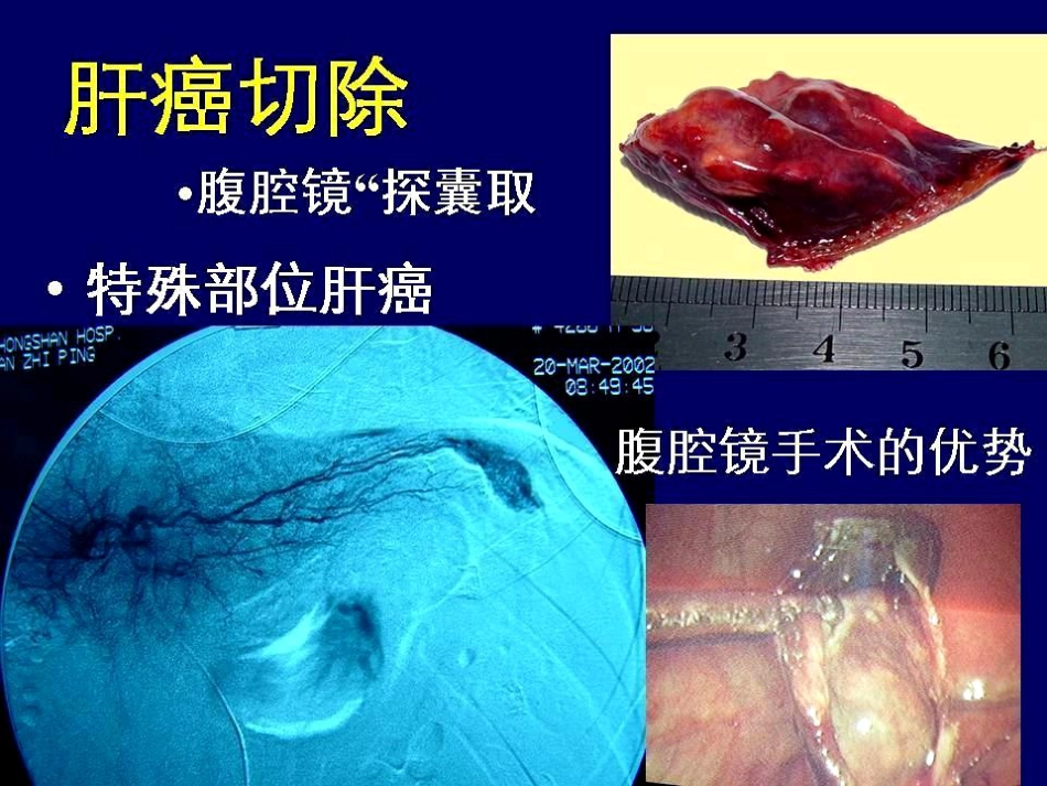 d时代肝胆胰外科PPT课件_第8页
