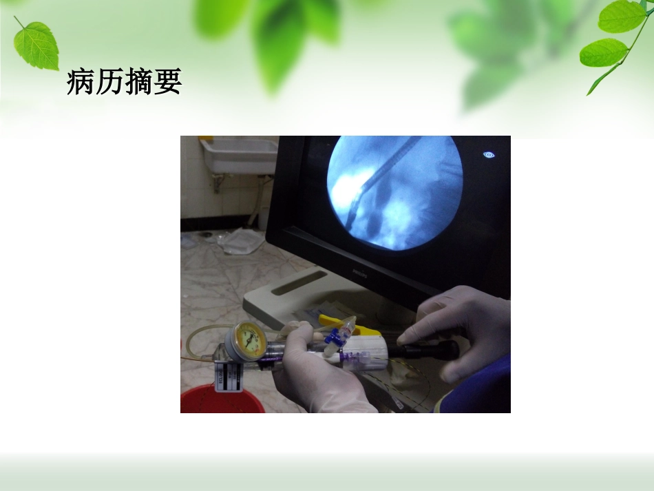 ERCP治疗胆总管结石_第13页