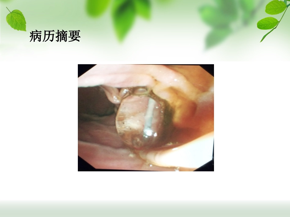 ERCP治疗胆总管结石_第14页