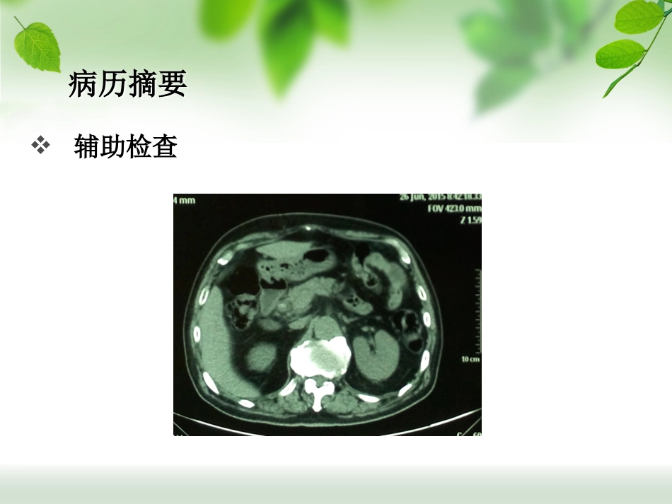 ERCP治疗胆总管结石_第9页