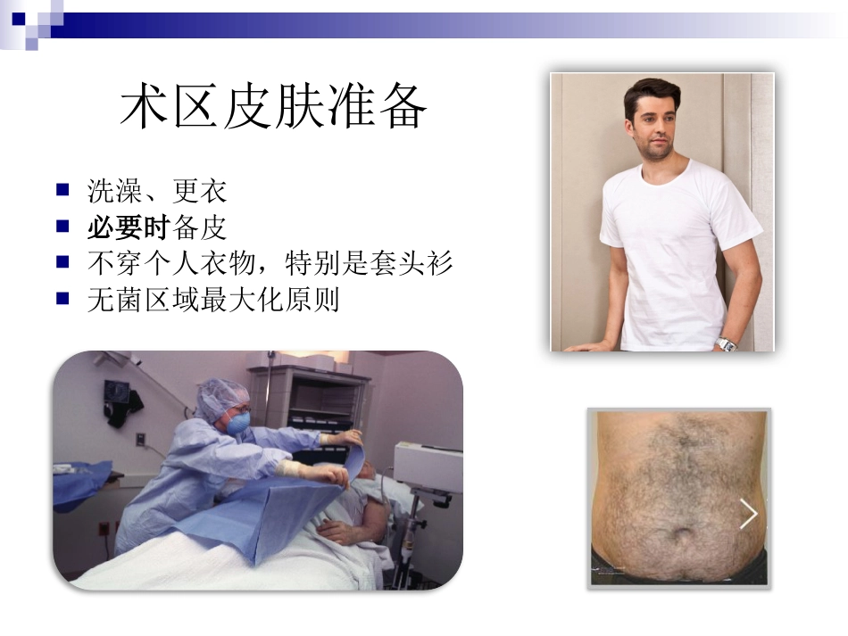 超声引导下微波消融治疗肝癌及护理_第15页