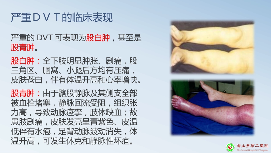 深静脉血栓预防PPT课件_第11页