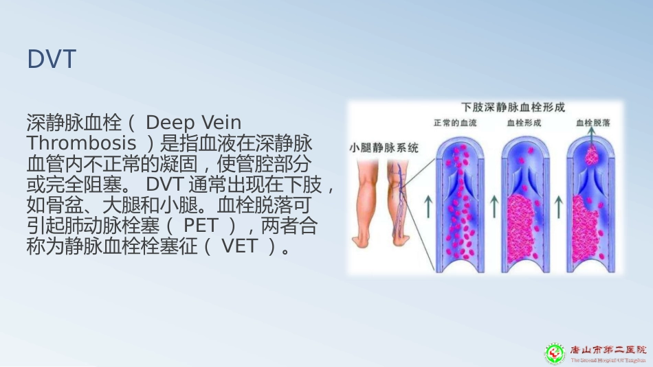 深静脉血栓预防PPT课件_第3页