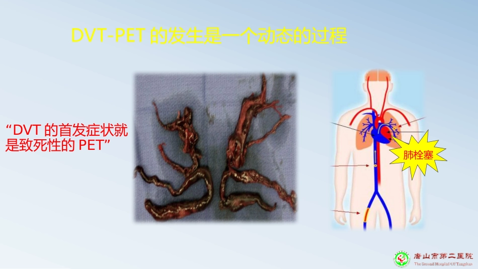 深静脉血栓预防PPT课件_第8页