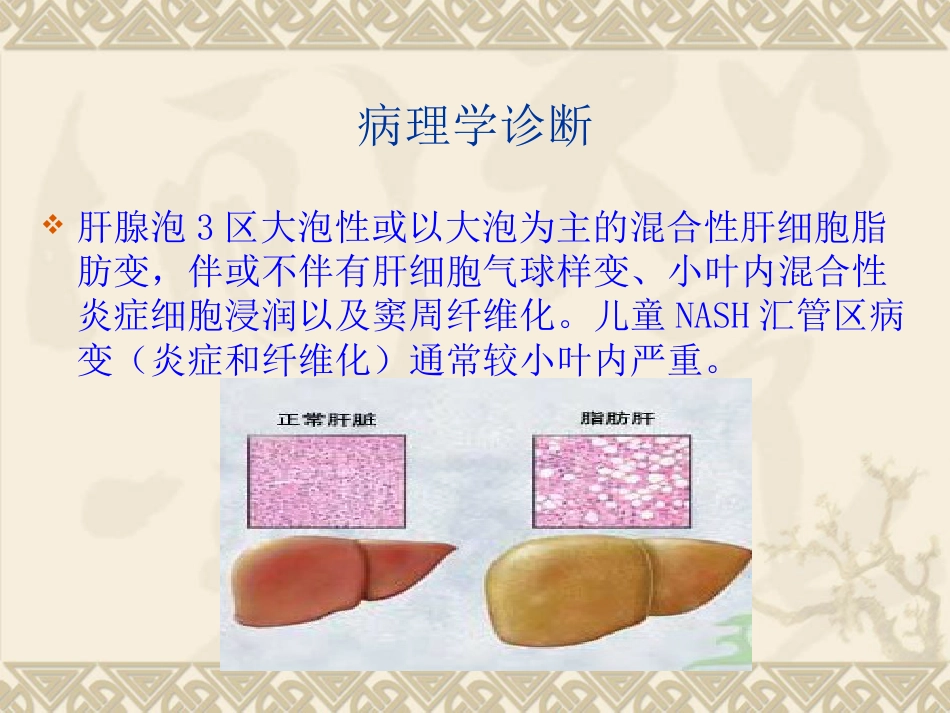 非酒精性脂肪性肝病(1)_第9页