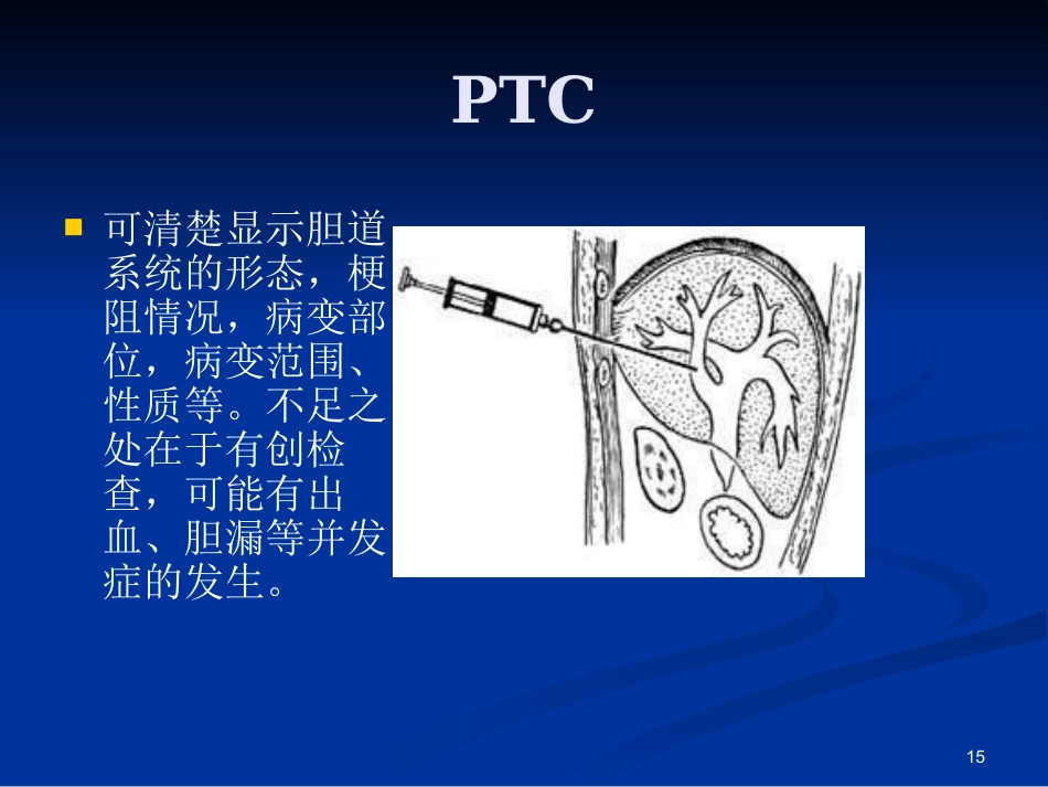 胆道疾病ppt课件(1)_第15页