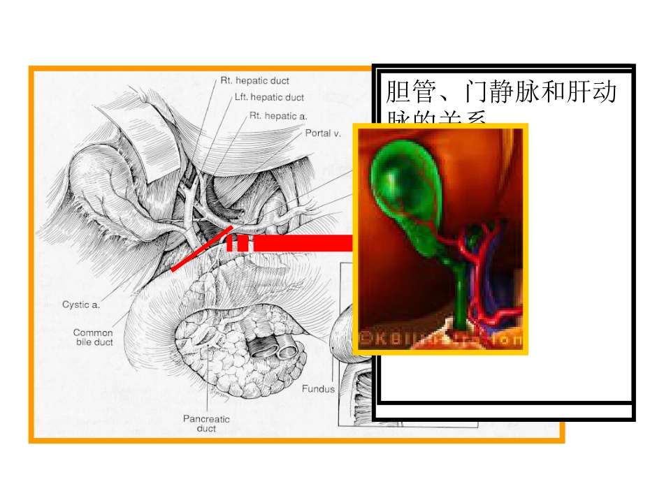 胆道疾病(1)_第6页
