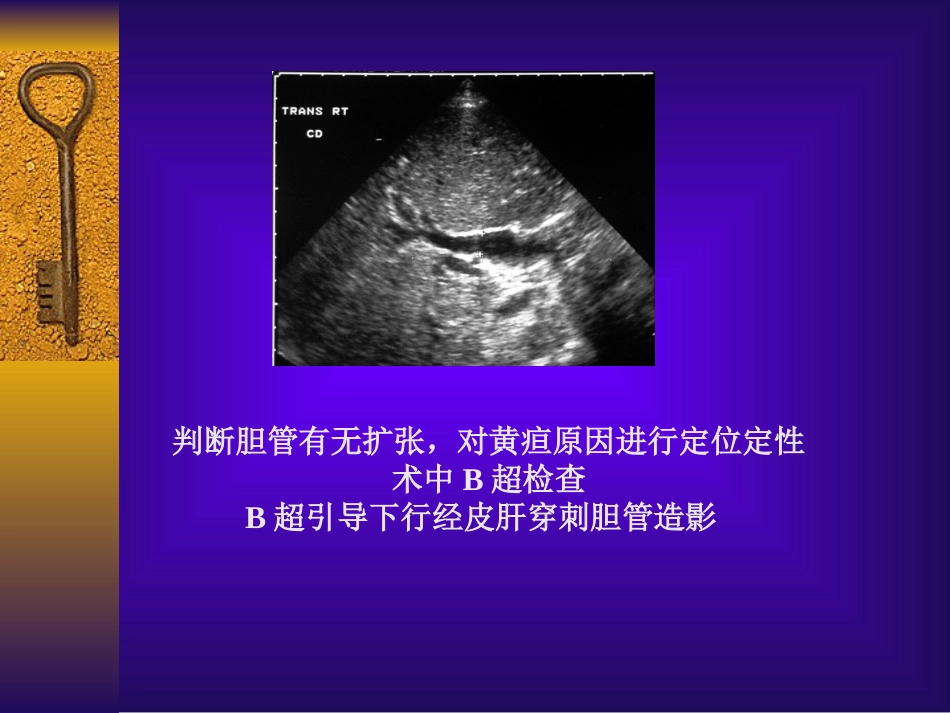 胆道疾病(3)_第15页