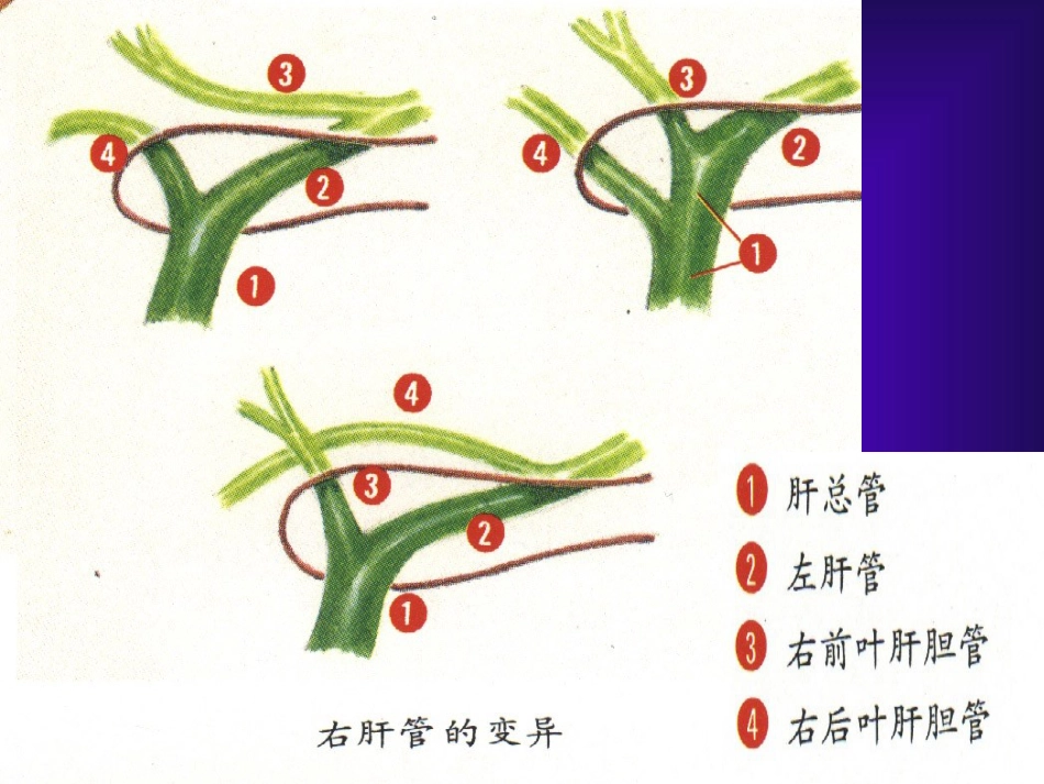 胆道疾病(3)_第4页