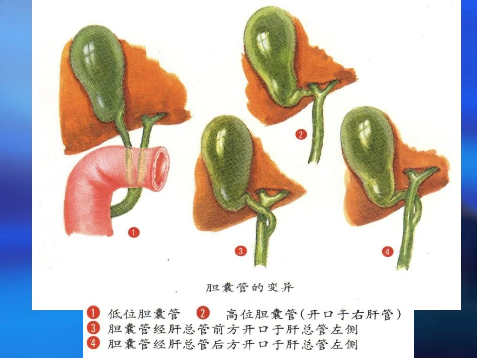 胆道疾病(4)_第13页
