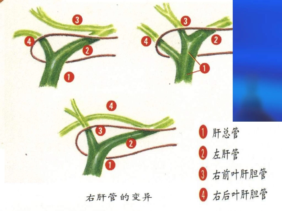 胆道疾病(4)_第8页