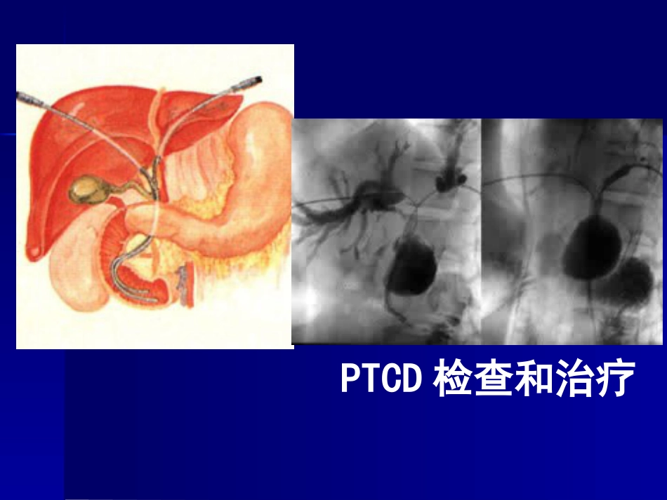 胆道疾病(11)_第12页
