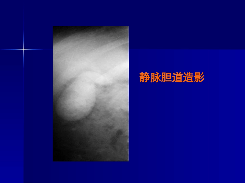 胆道疾病(11)_第15页