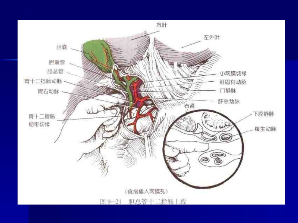 胆道疾病(11)_第5页