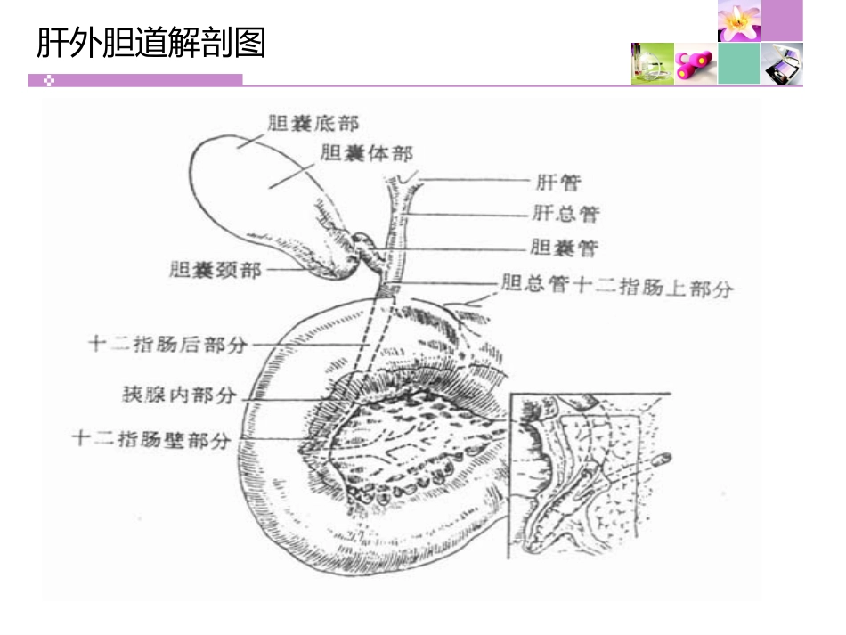 胆囊切除胆总管切开取石11月份查房 PPT课件_第7页