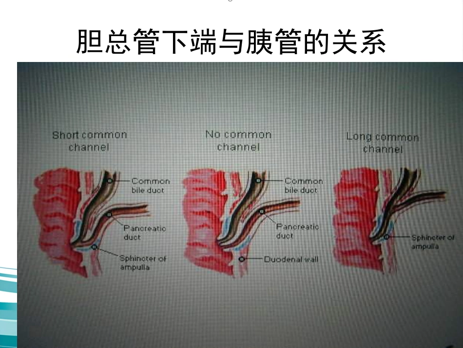 胆道疾病(12)_第14页