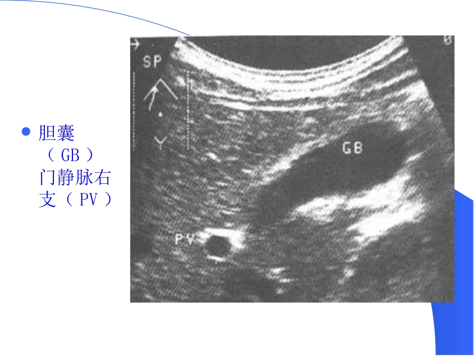 胆道疾病(13)_第13页
