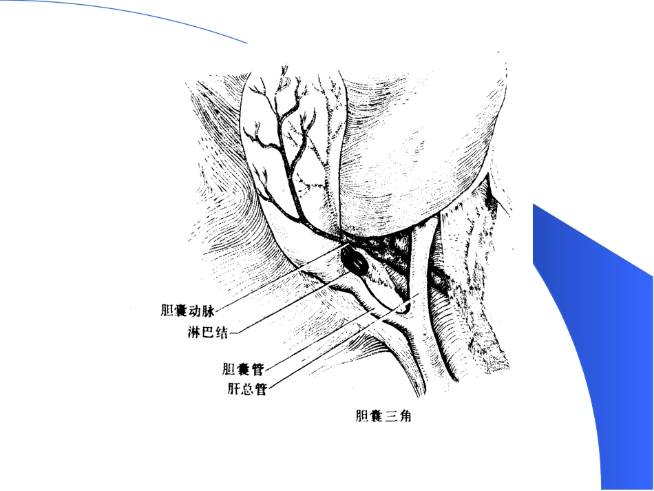 胆道疾病(13)_第4页