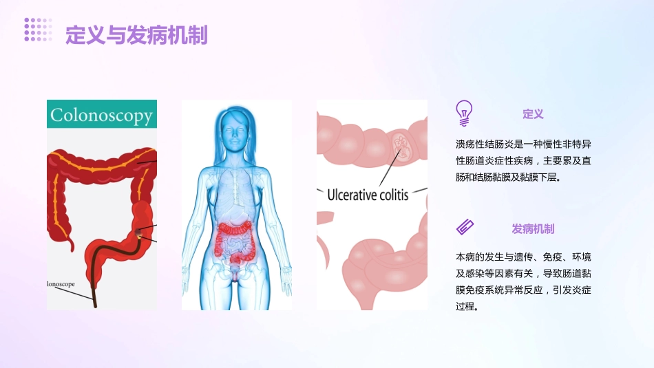 2024《溃疡性结肠炎》PPT课件_第4页