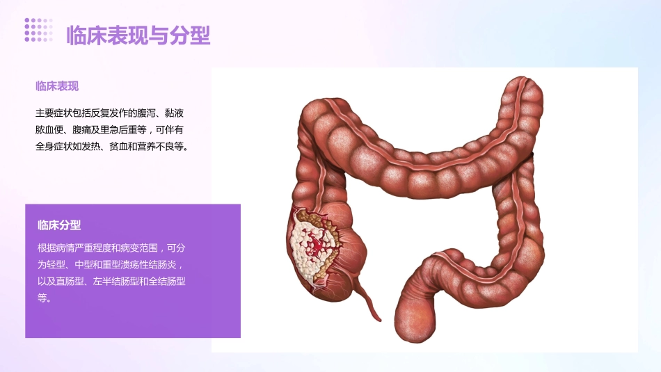 2024《溃疡性结肠炎》PPT课件_第6页