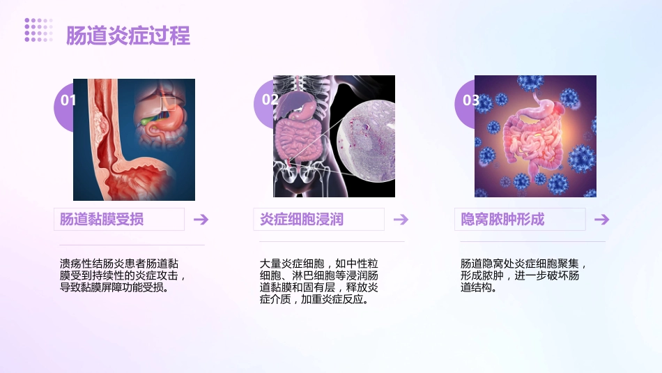 2024《溃疡性结肠炎》PPT课件_第9页