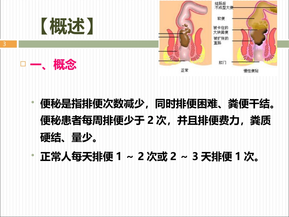 便秘ppt课件_第3页