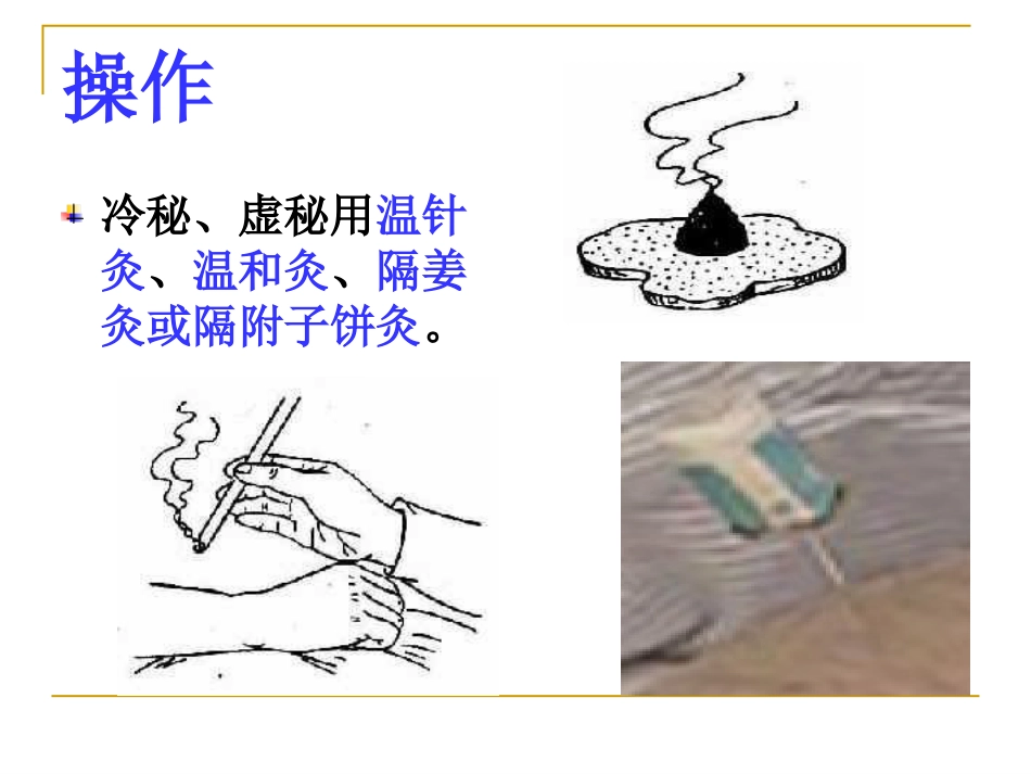 便秘完整手册_第9页