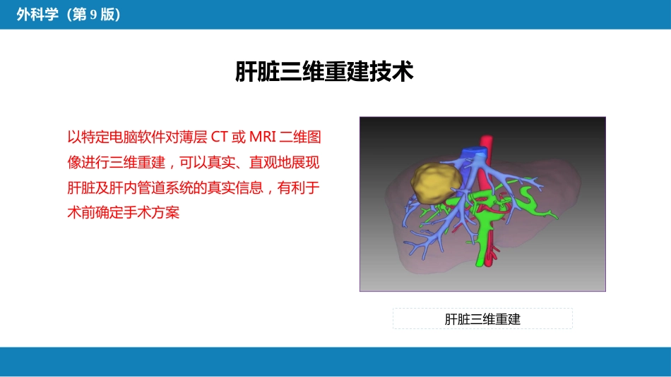 肝疾病 第五、六、七节_第15页