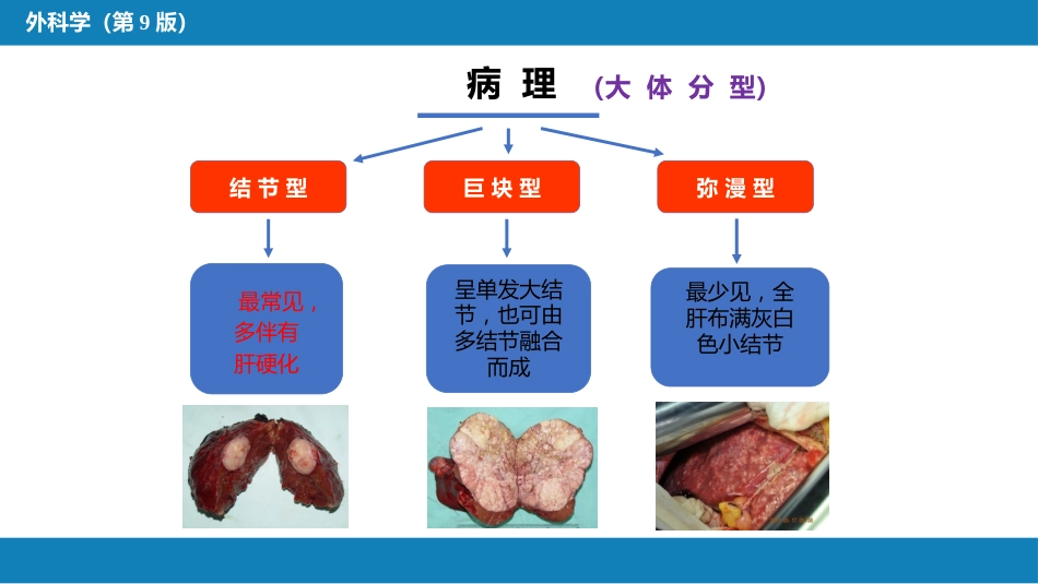 肝疾病 第五、六、七节_第8页
