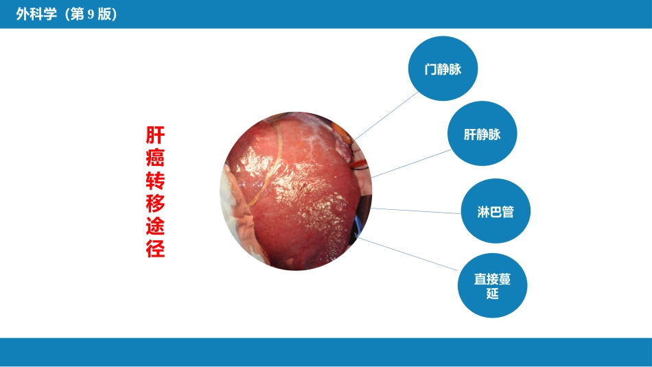肝疾病 第五、六、七节_第9页