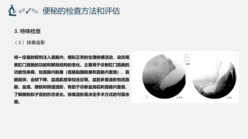 便秘外科诊疗规范_第12页