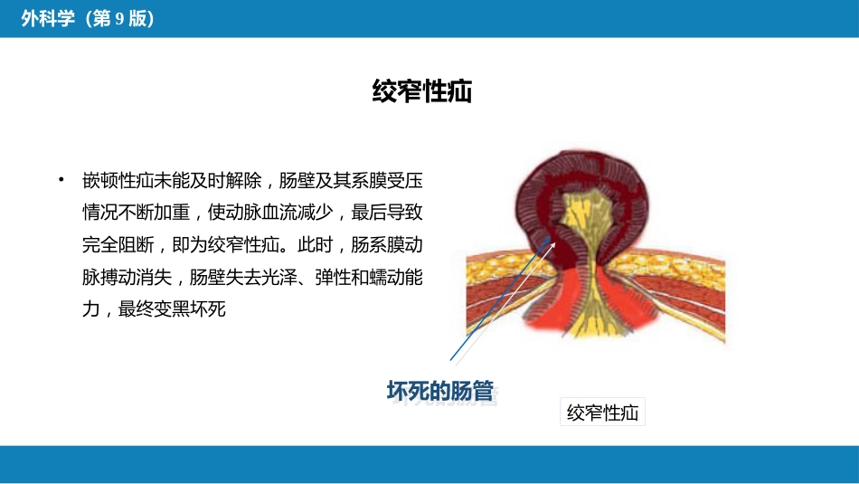 外科学： 腹外疝_第13页