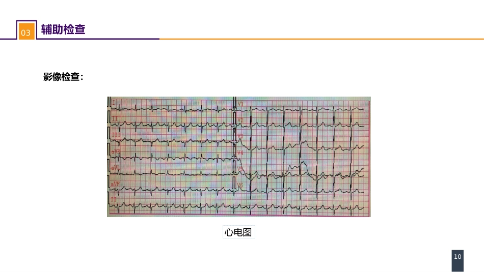 急性化脓性腹膜炎 案例分析-继发性腹膜炎_第10页
