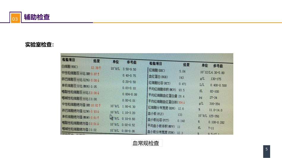急性化脓性腹膜炎 案例分析-继发性腹膜炎_第5页