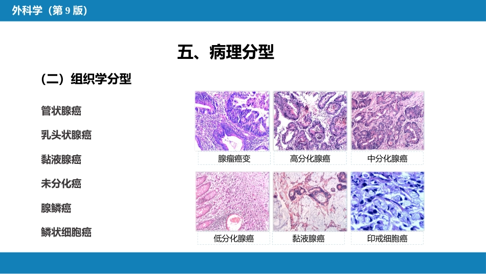 结、直肠与肛管疾病 第六节 结肠癌_第10页