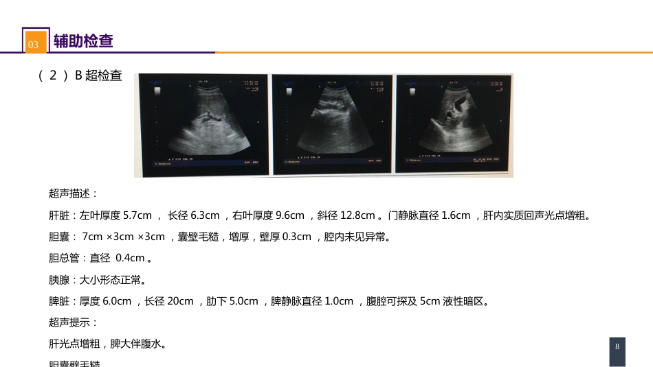 门静脉高压症 案例分析-门静脉高压症_第8页