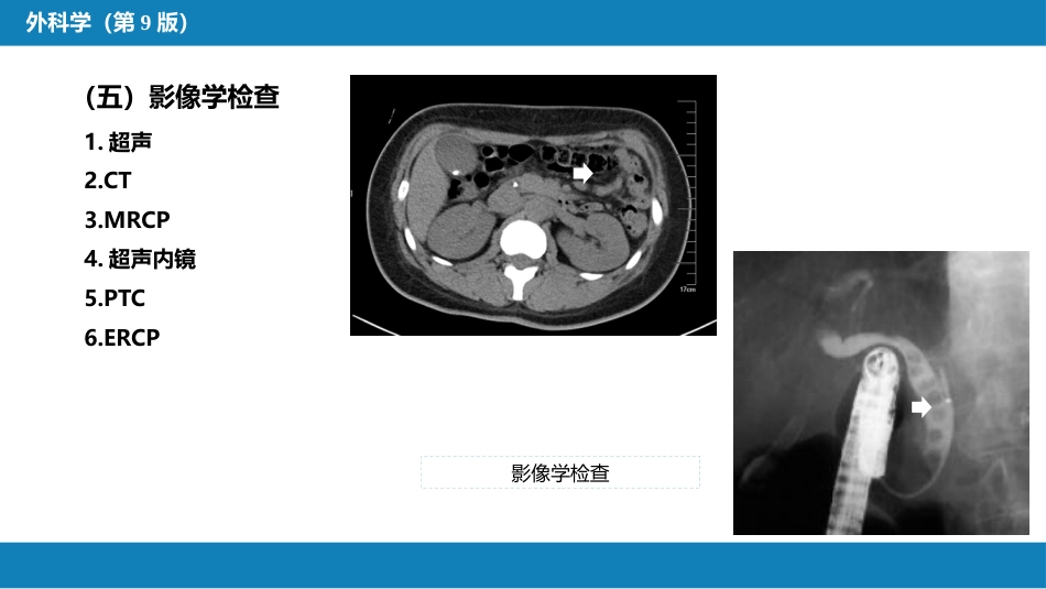 胆道疾病 第四、五、六节_第13页