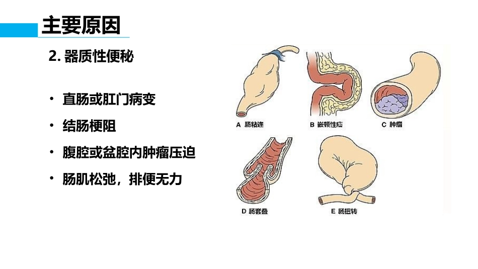 便秘病人评估_第7页